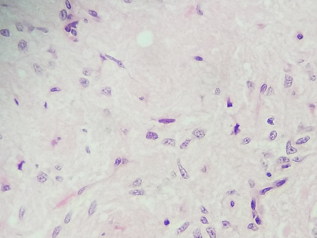 Pituitary Gland Slides - Pituitary Gland 011 400X